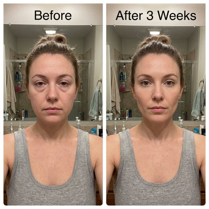 Velori® Lymphatic Drainage Drops